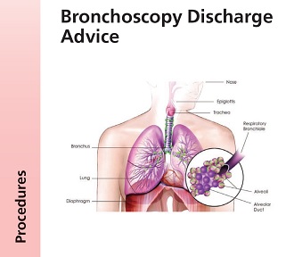 Bronchoscopy Discharge Advice