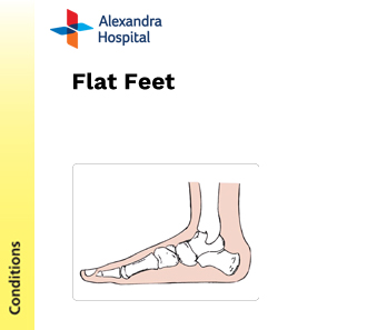 POD - Flat Feet