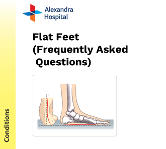POD - Flat Feet FAQ
