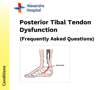 POD - Posterior Tibal Tendon Dysfunction FAQ