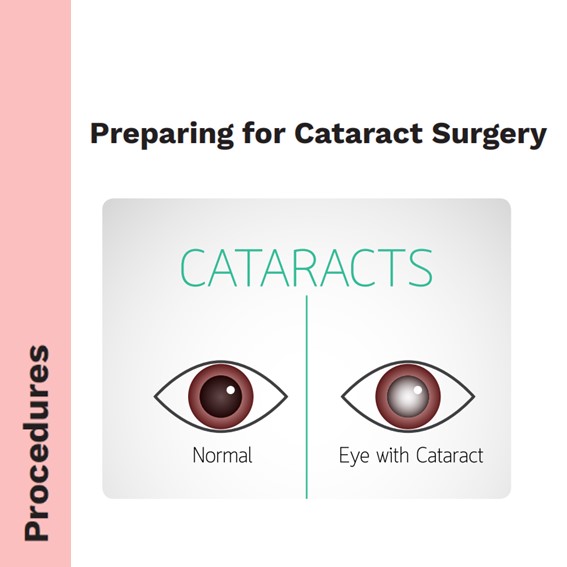 DSOT - Preparing for Cataract Surgery